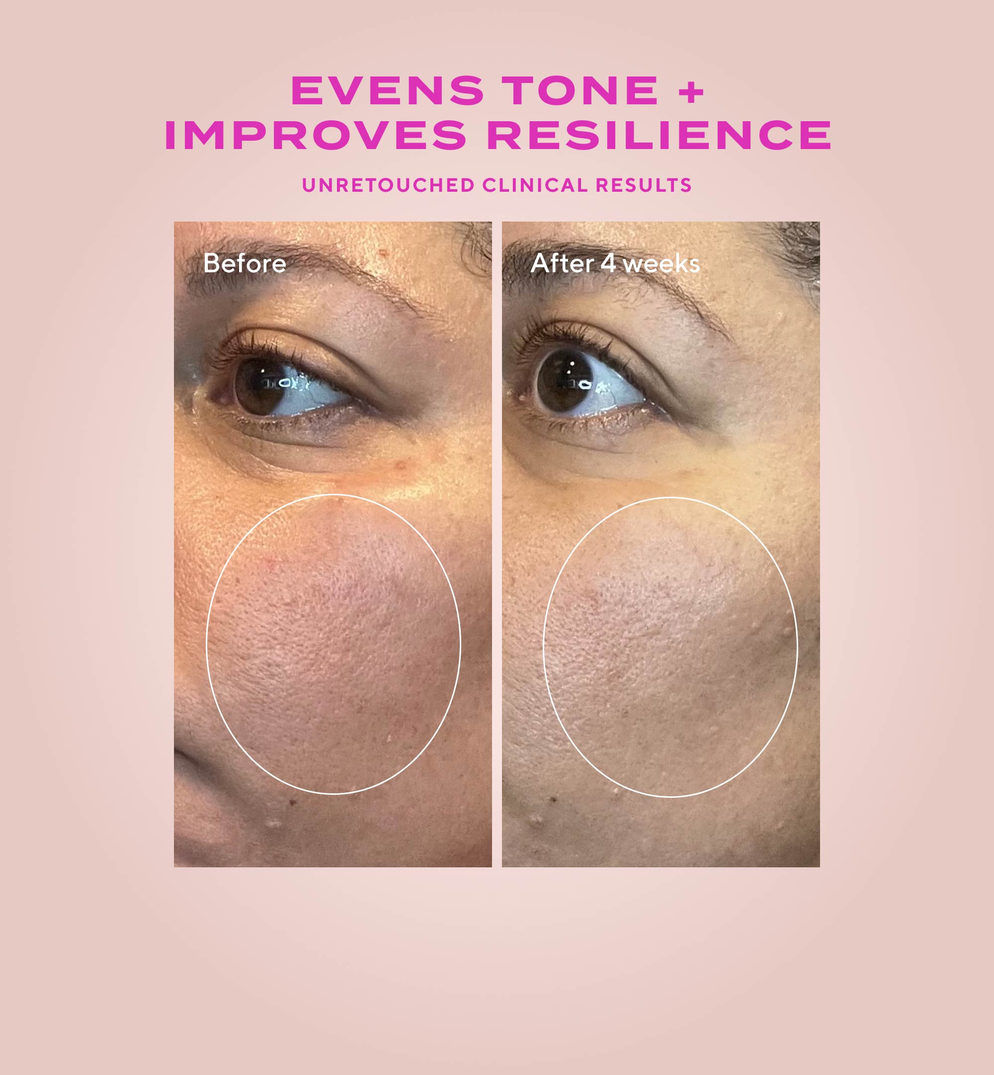 Gentle Glycolic Acid Resurfacing Serum for Sensitive Skin - Image 5