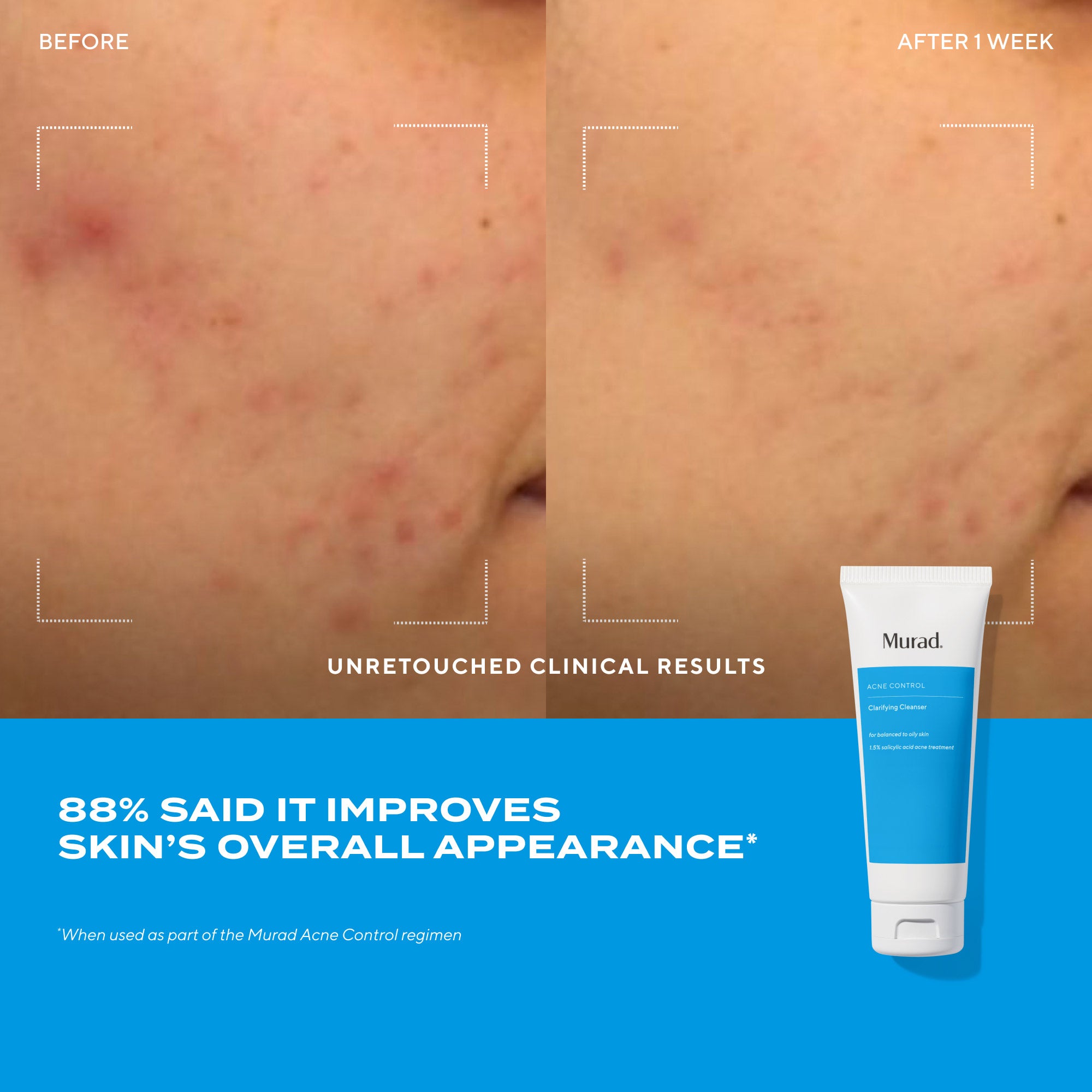 Clarifying Cleanser Value Size - Image 6