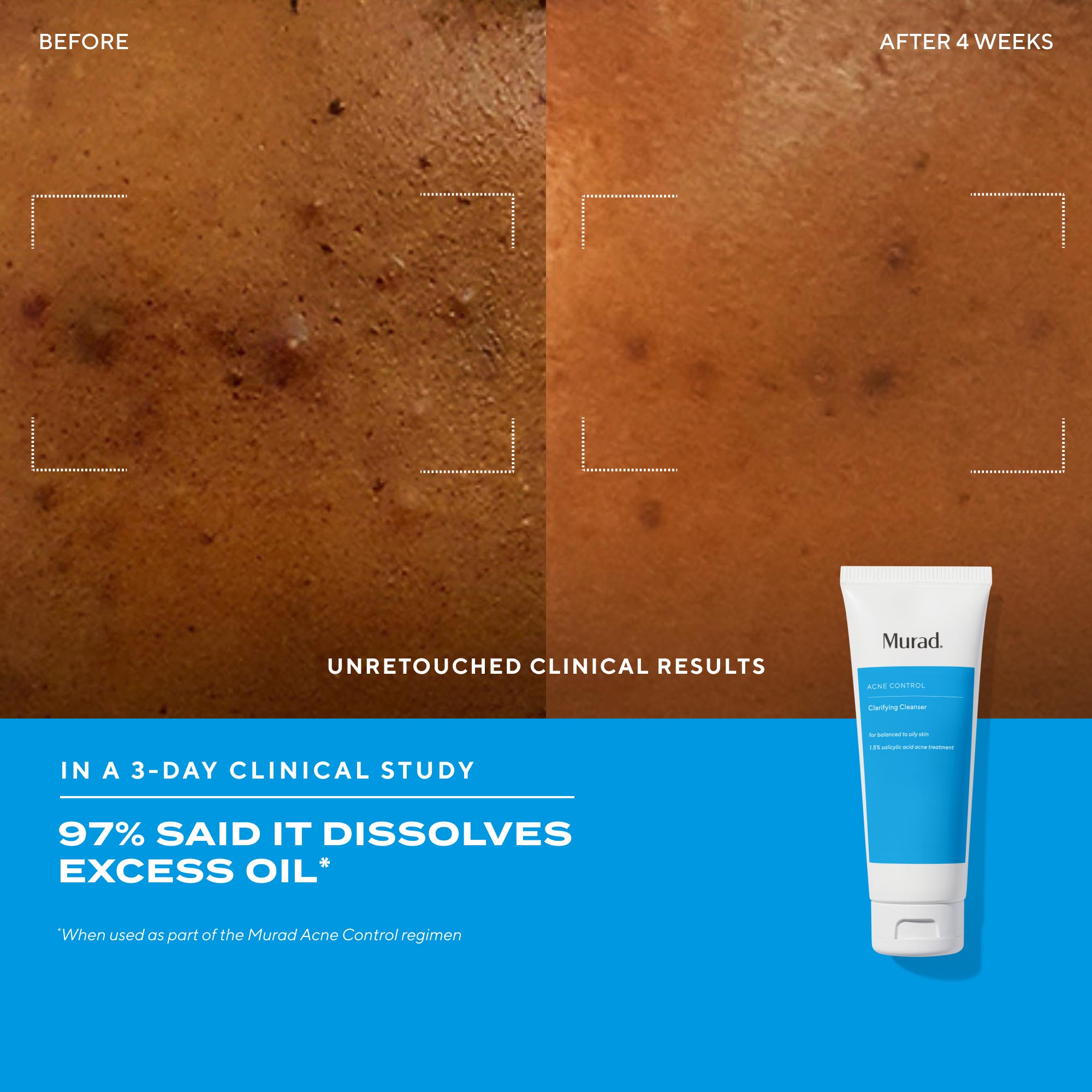 Clarifying Cleanser Value Size - Image 7