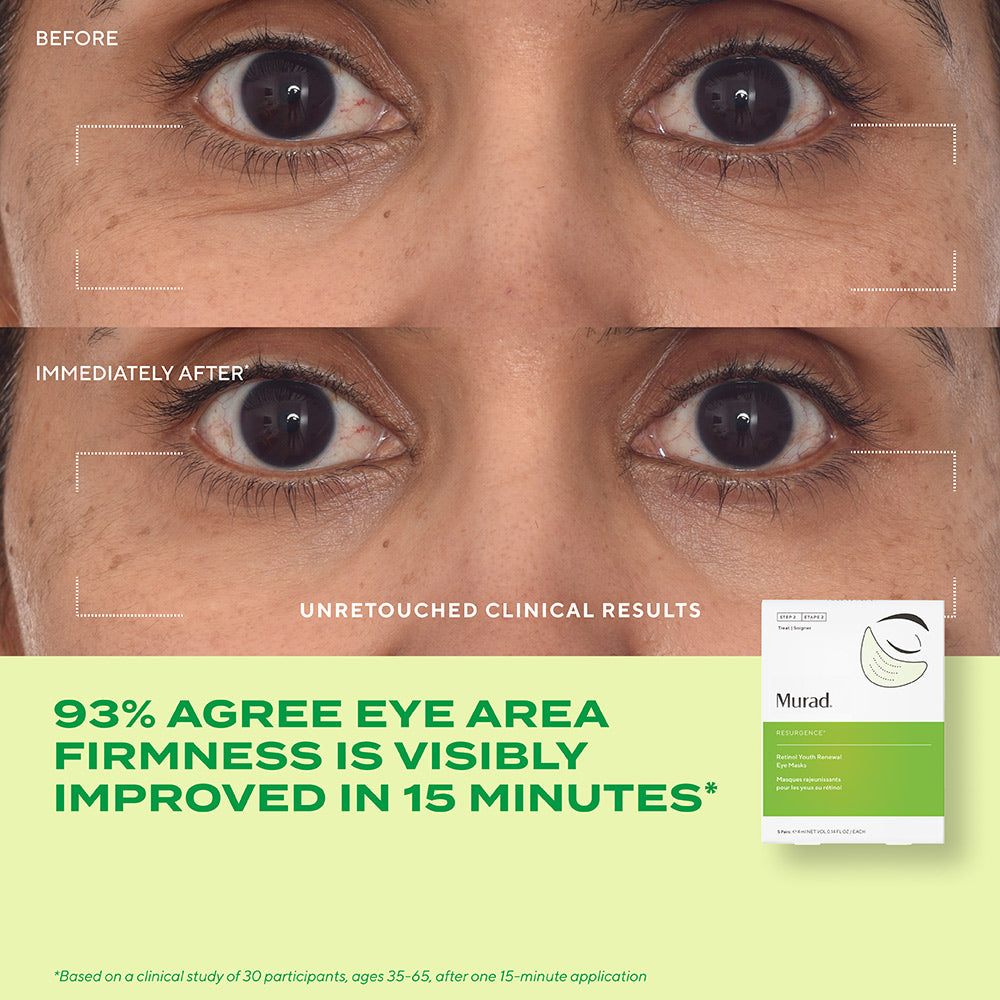 Retinol Youth Renewal Eye Mask - Image 4