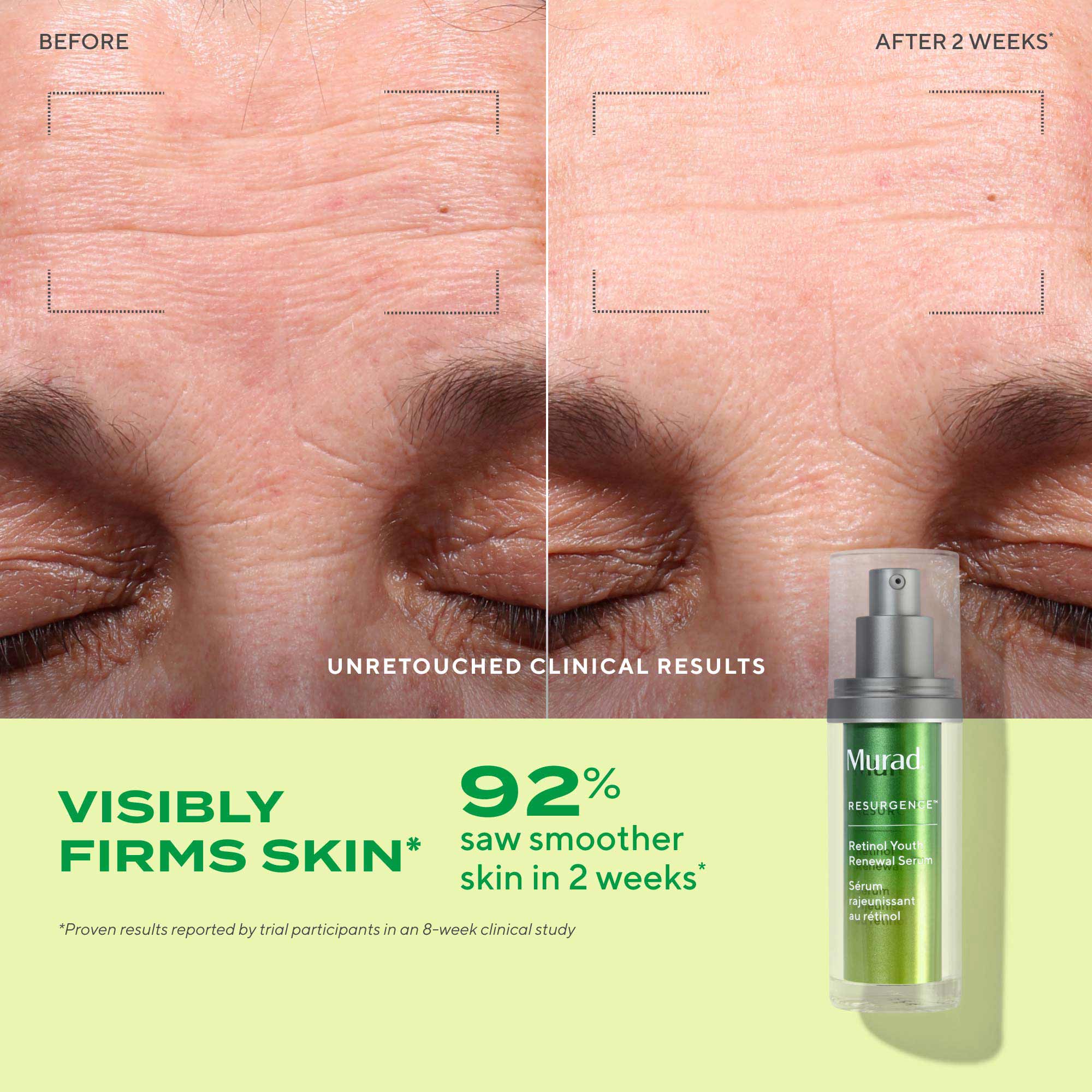 Active Renewal Regimen 90-Day Kit - Image 2