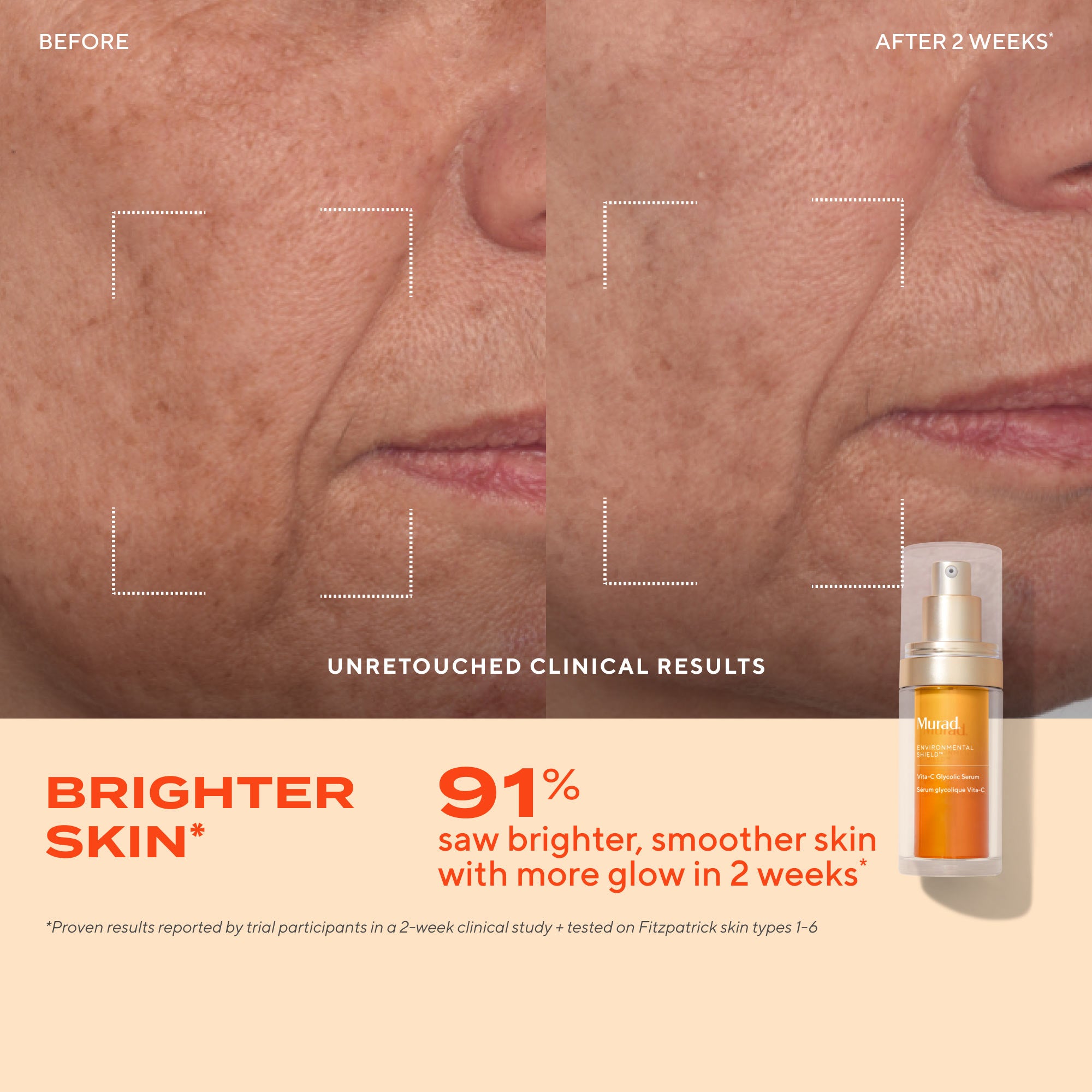 Vita-C Glycolic Serum Refill Savings Bundle - Image 4