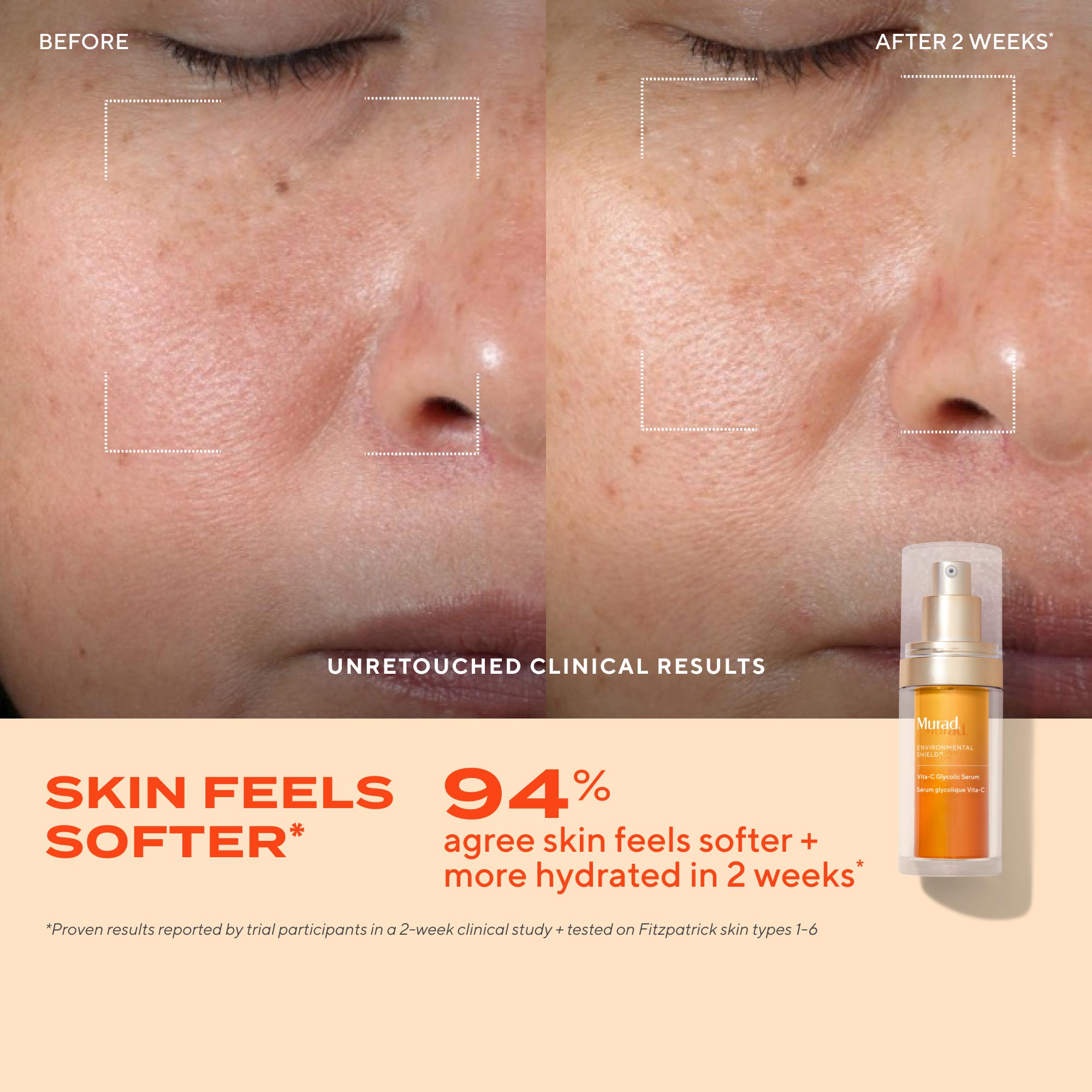 Vita-C Glycolic Serum Refill Savings Bundle - Image 5