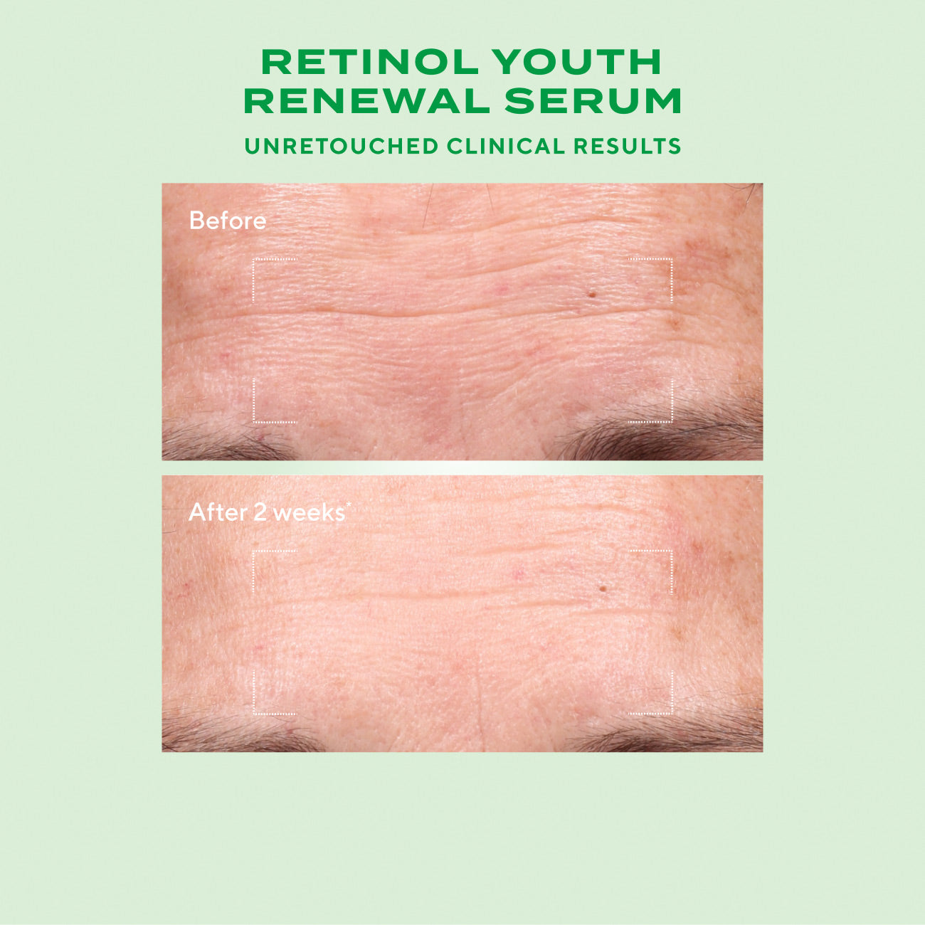 Derm Clinic: Target Wrinkles Value Set - Image 4