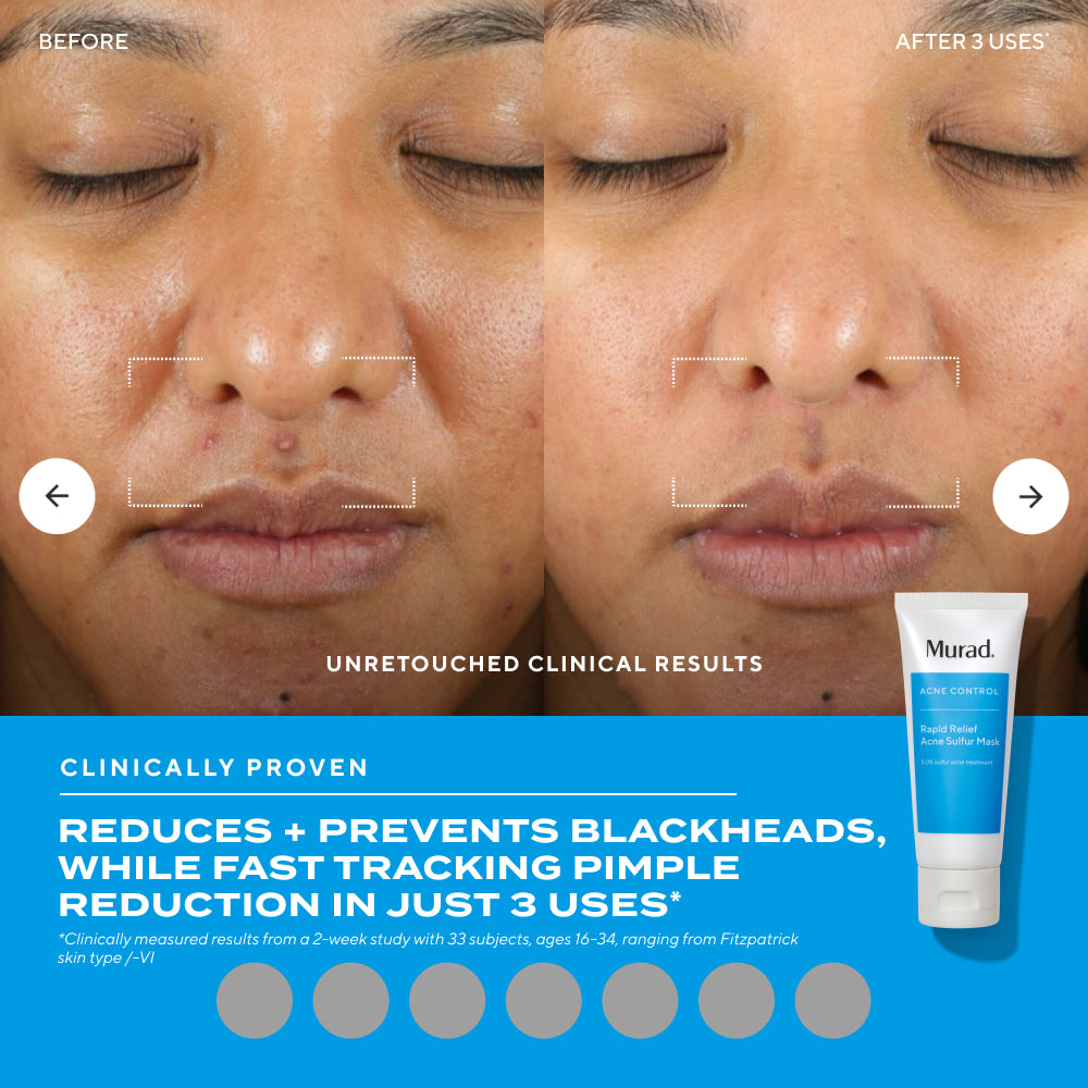 Derm Clinic: Target Breakouts + Scars Value Set - Image 4