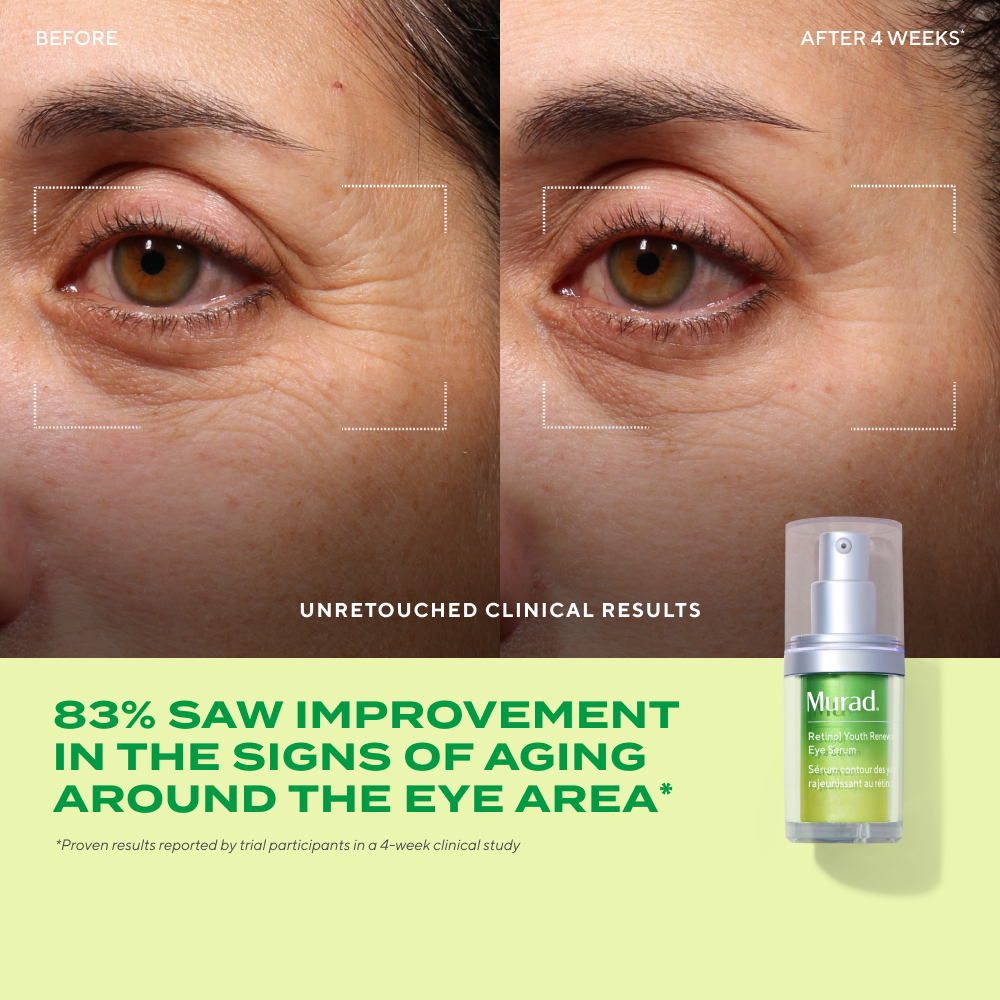 Derm Clinic: Target Eye Wrinkles Value Set - Image 3
