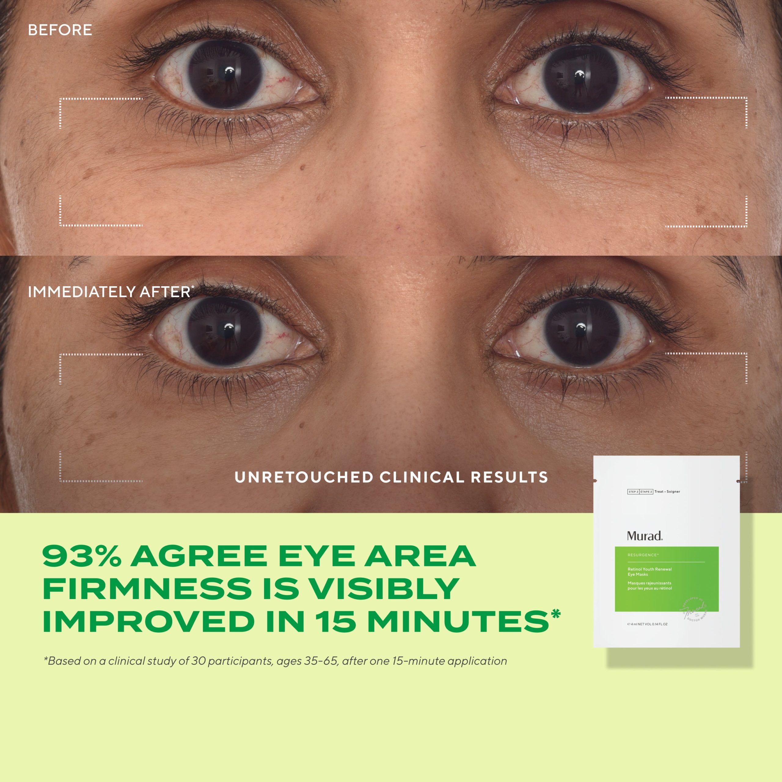 Derm Clinic: Target Eye Wrinkles Value Set - Image 4
