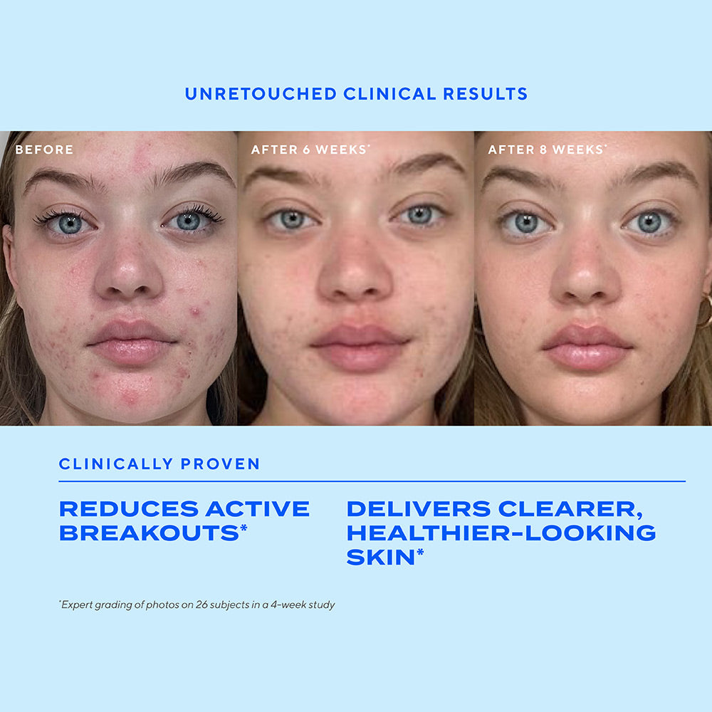 Biome-Balancing Clear & Prevent Acne Treatment Serum - Image 3