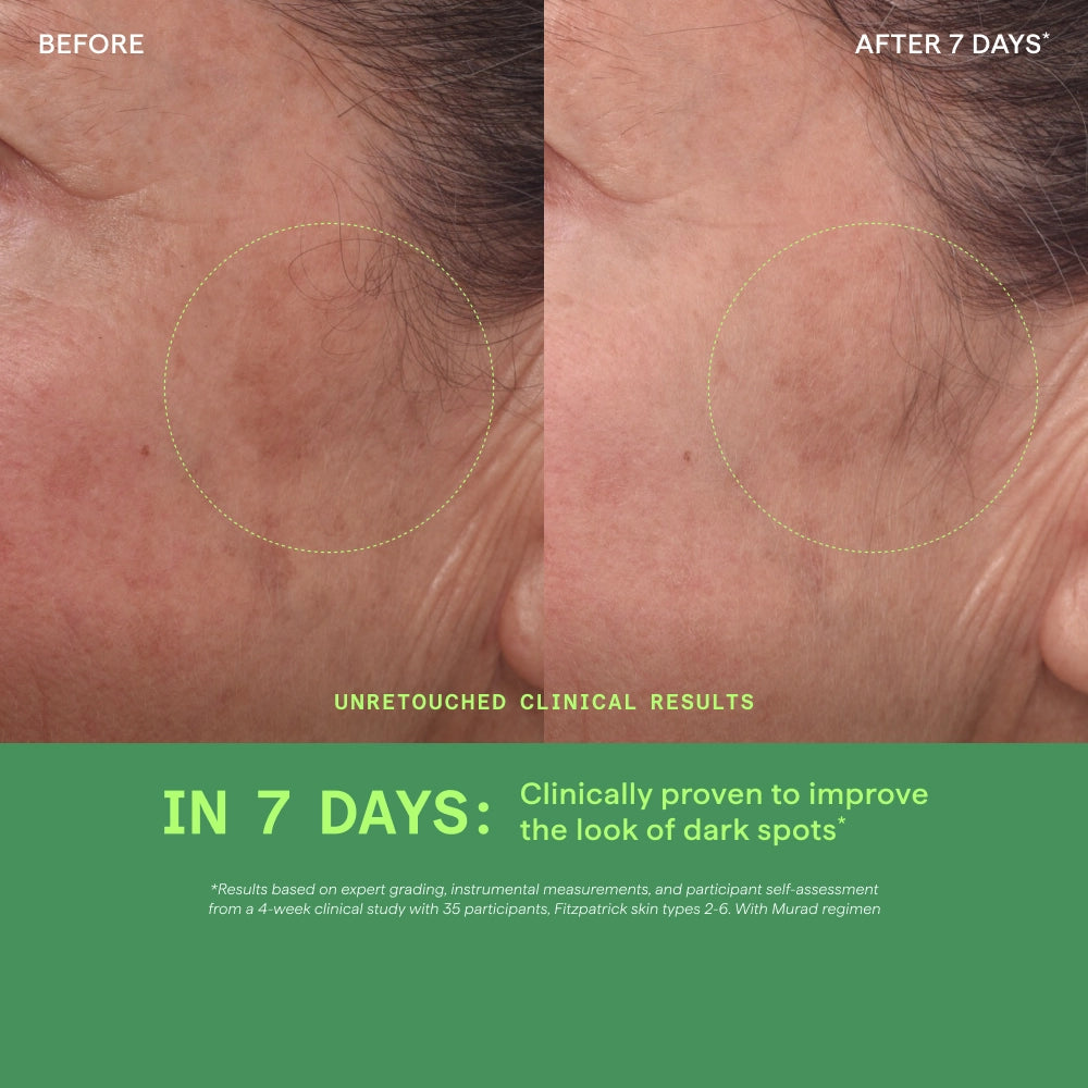Rapid Dark Spot Correcting Serum - Image 5