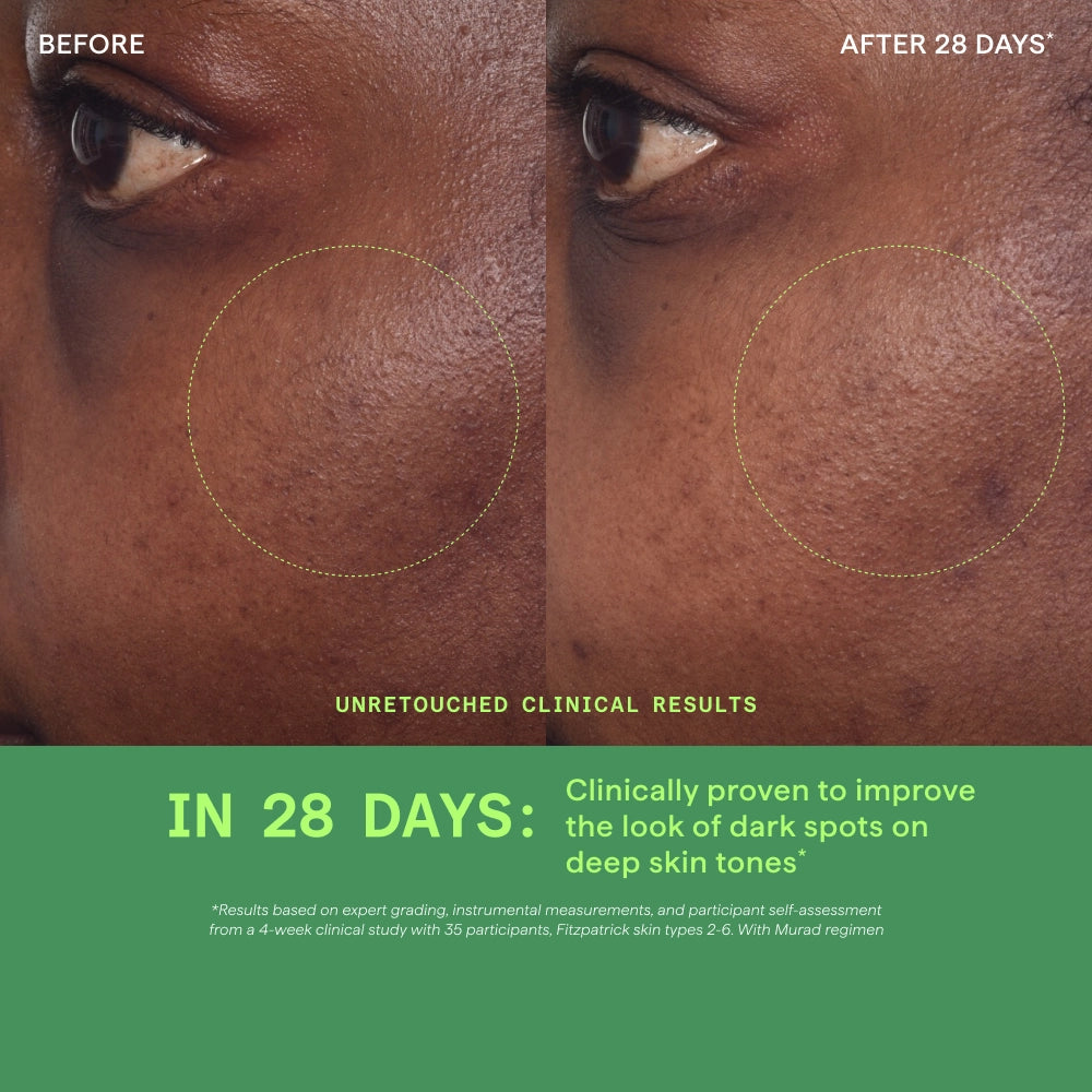 Rapid Dark Spot Correcting Serum - Image 7