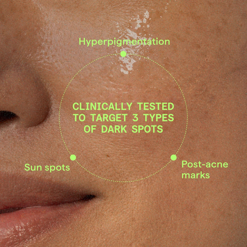 Rapid Dark Spot Correcting Serum - Image 9