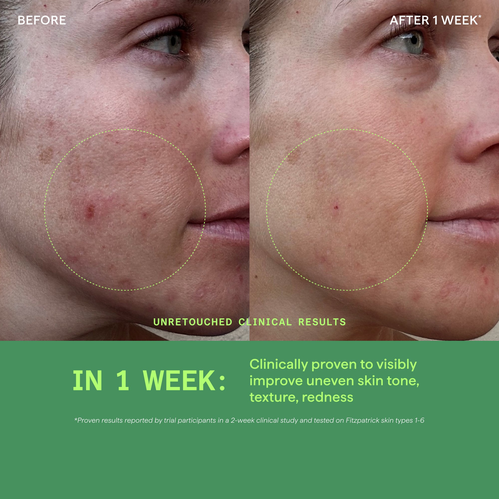 Biome-Balancing Calm & Recover Cream - Image 3