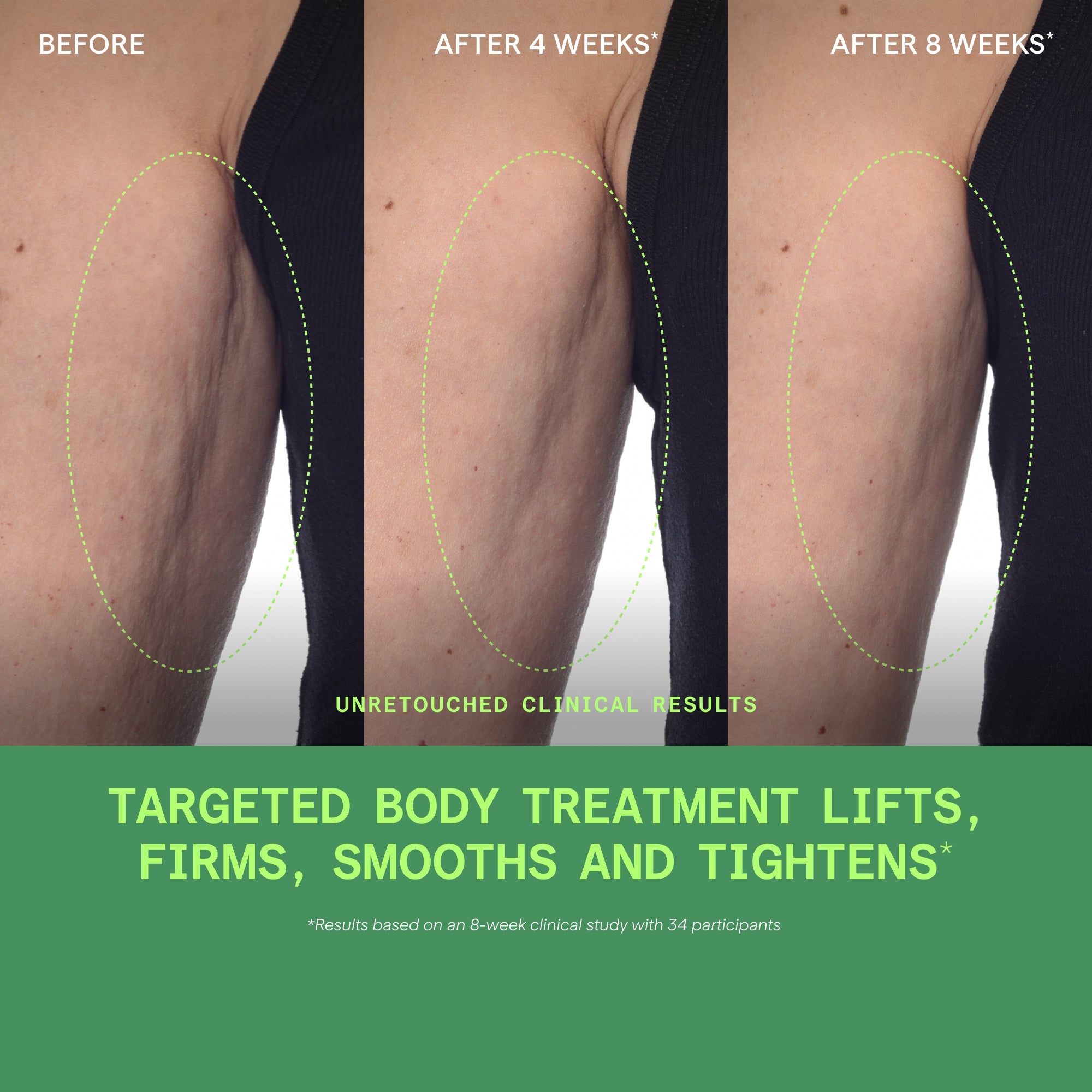 Retinal ReSculpt Body Treatment - Image 6