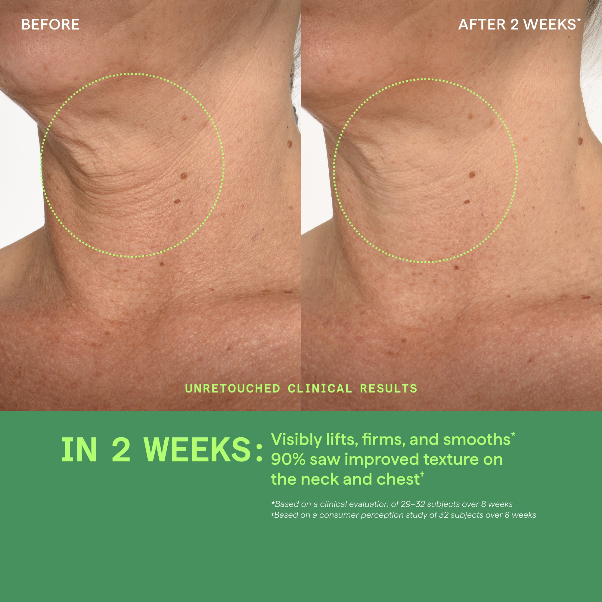Retinal ReSculpt Neck & D??collet?? Lifting Serum - Image 4