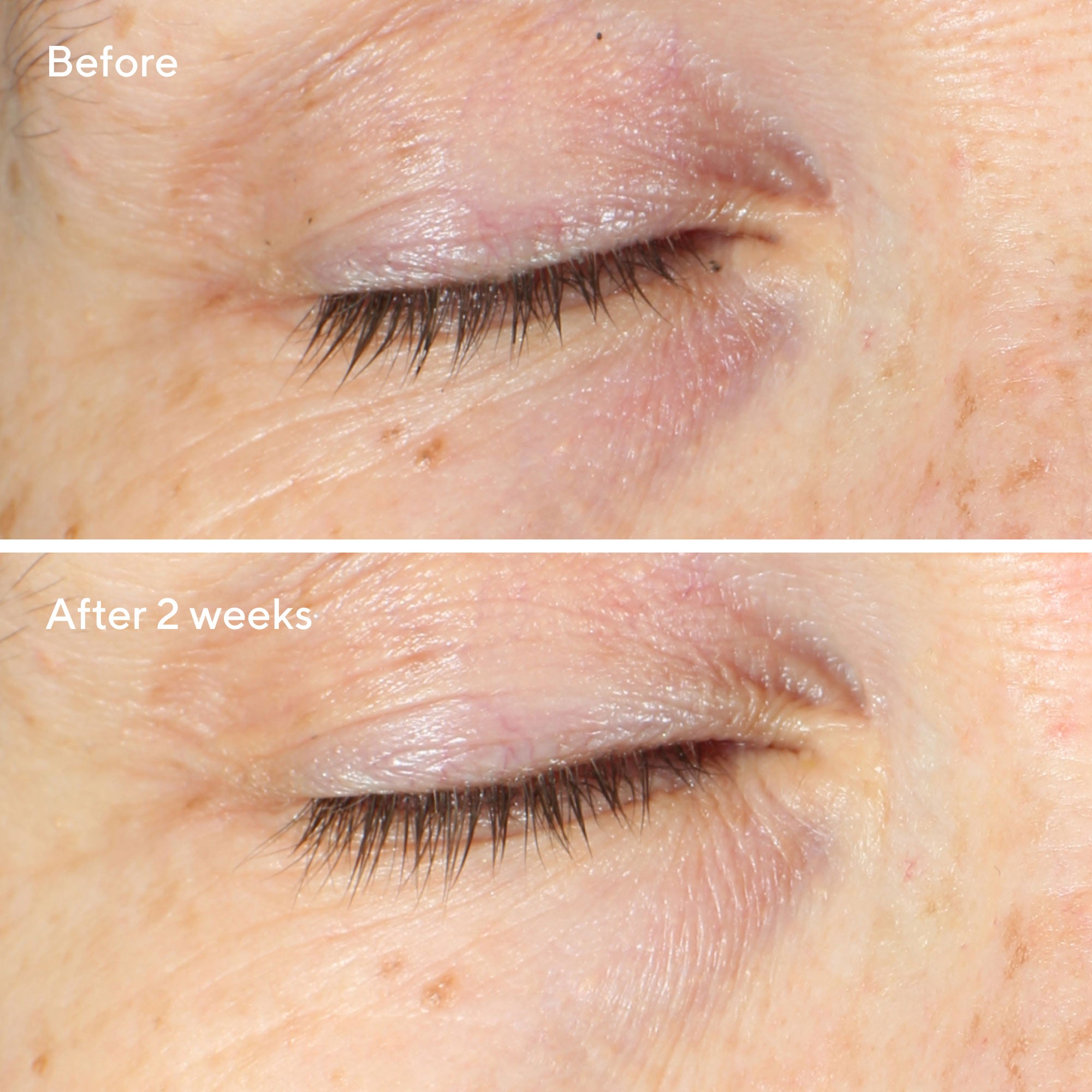 Vita-C Eyes Dark Circle Corrector - Image 4